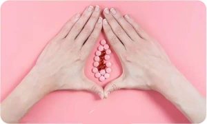 عفونت قارچی واژن چیست؟