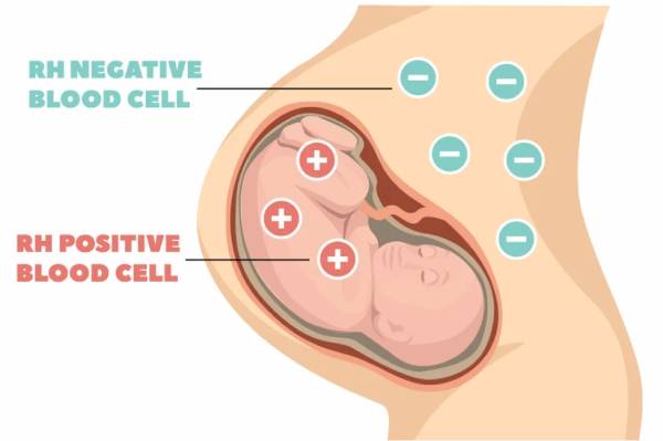 ناسازگاری خونی مادر وکودک