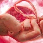 علت سقط مکرر چیست؟ سقط مکرر جنین