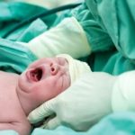 آسیب های حین زایمان به نوزاد