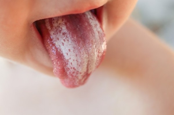 تمیز کردن زبان کودک