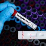 عفونت انگلی توکسوپلاسموز عفونت انگلی توکسوپلاسموز