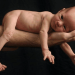 نشانه های پارگی کیسه آب کودکی که روی دست پدرش است