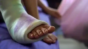 شکستگی پا در کودکان