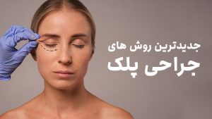 جدیدترین روش های جراحی پلک