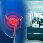 درمان یائسگی زودرس