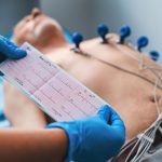 ایا نوار قلب گرفتگی عروق را نشان میدهد؟ پاسخ پزشکان را ببینید! نوار قلب گرفتگی عروق