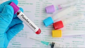 آیا پایین بودن پلاکت خون در نوزادان خطرناک است؟