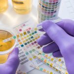 آیا خواندن جواب آزمایش خون و ادرار در خانه ممکن است؟ خواندن جواب آزمایش خون و ادرار در خانه