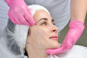 لیفت با نخ آپتوس؛ جوانسازی صورت بدون جراحی در مرکز تخصصی دکتر کیان‌پیشه