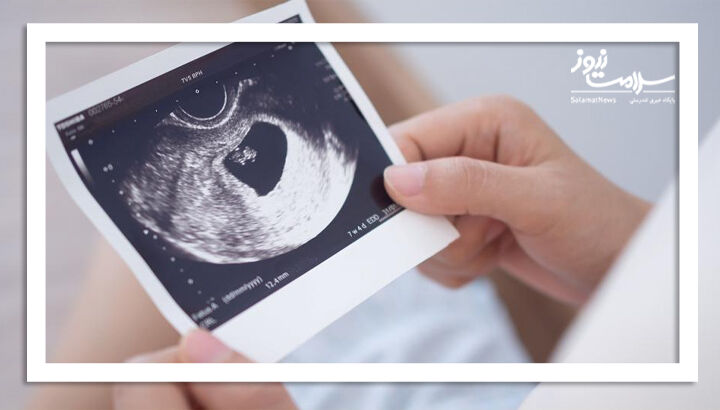 سن و تأثیر آن بر باروری زنان: آیا سن محدودیتی برای بارداری ایجاد می‌کند؟