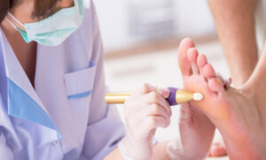 مراقبت بعد از سوزاندن میخچه؛ بعد از سوزاندن میخچه چه مراقبت‌هایی لازم است؟