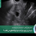 بارداری پوچ چیست و چرا اتفاق می‌افتد؟